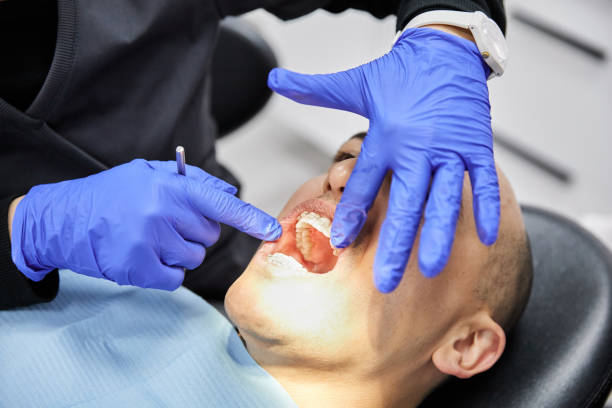 Best Emergency Dentist for Knocked-Out Tooth in Cheviot, OH